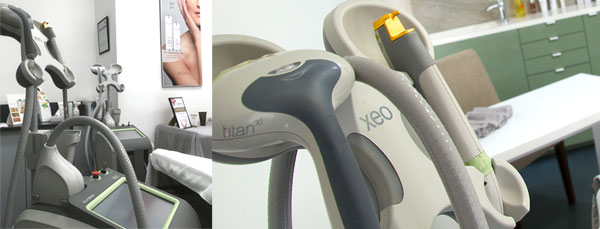 laser hair removal and skin rejuvenation machines in our bolton laser clinic