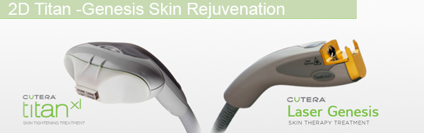 cutera titan combined with laser  genesis the ultimate and effective skin tightening and rejuvenation treatment the laser genesis laser head and the Titan ipl head 
