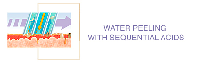 diagram showing the water peeling with sequential acids how it cleans using vacume power to remove dead heads, dead skin cells